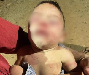 Mãe sai para trabalhar e pai espanca bebê de apenas 4 meses na Capital